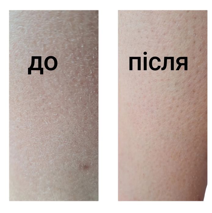 Пілінг Скраб Рукавичка Шовк Для Тіла