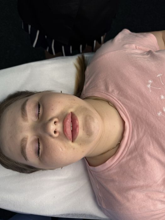 Збільшення губ. Потрібні моделі