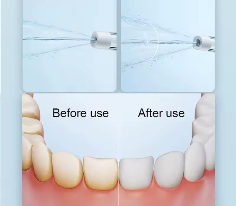 Бездротовий портативний іригатор XIAOMI MIJIA F300 Оригінал