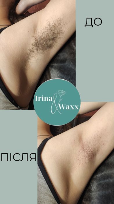 Воскова депіляція. Печерськ, Центр