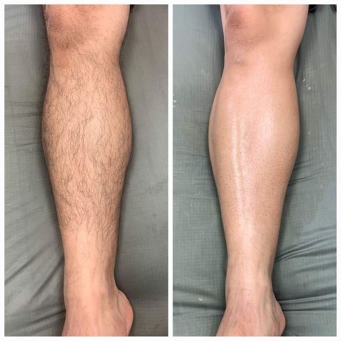 Depilacja męska różna