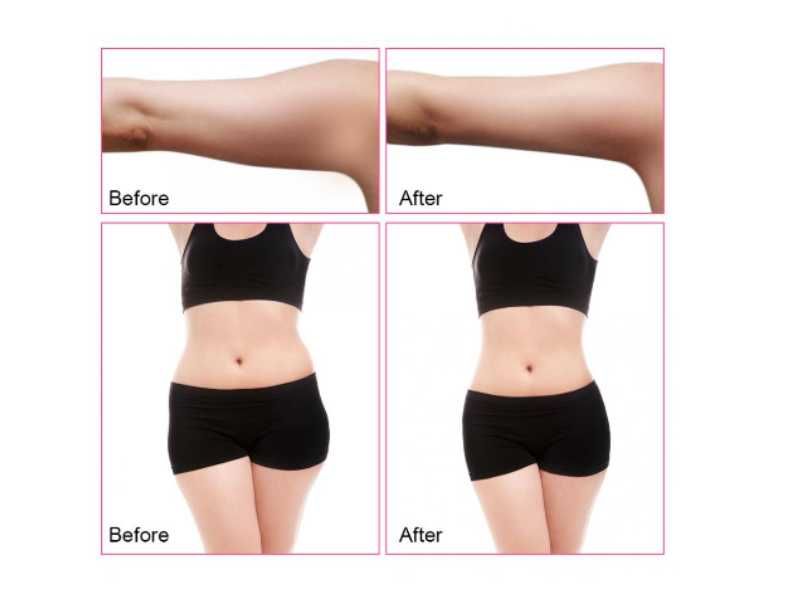 efektywna MASZYNA do WYSZCZUPLANIA ciała odmładzająca