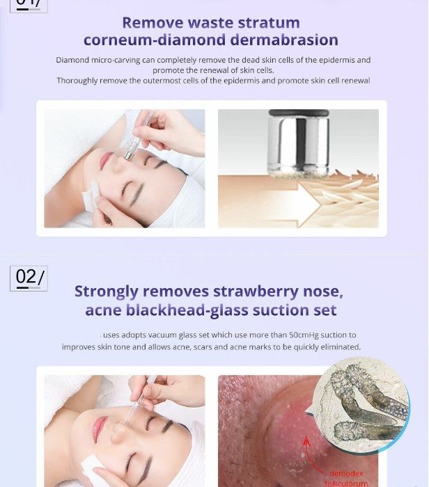 Maquina Microdermoabrasão + Vácuo+ Acessórios