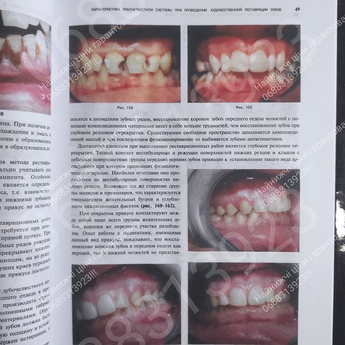 Встигни замовити!! Художественное моделирование .Стоматологія книга