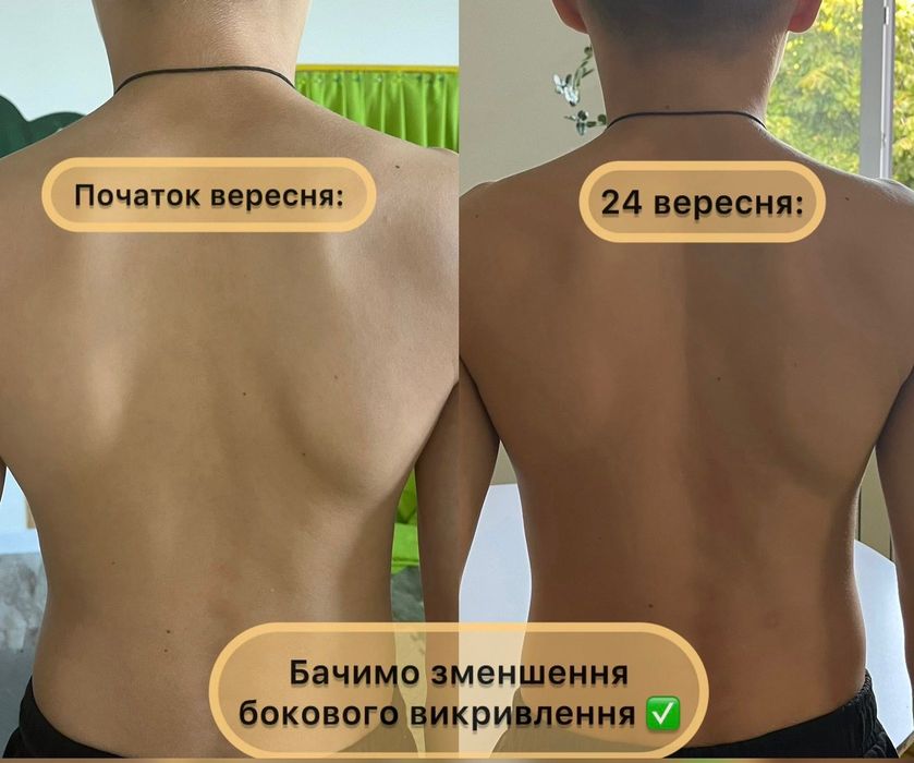 Масаж/ЛФК/Фізична терапія/Лікувальний масаж Умань