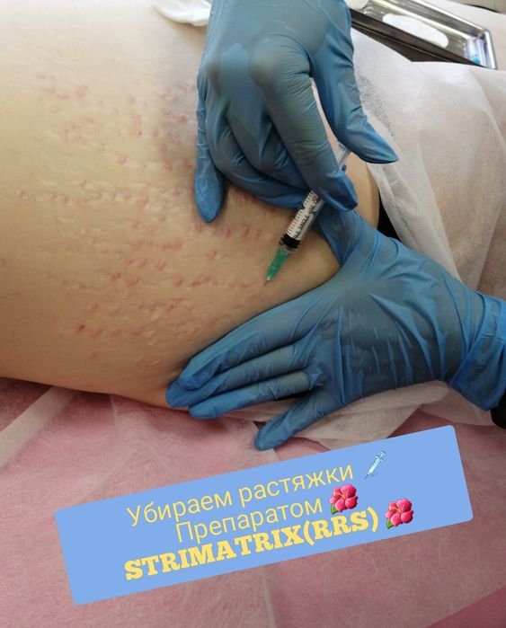 Косметолог.Увеличение губ  ,Чистка лица,Мезотерапия ,Плазмолифтинг.