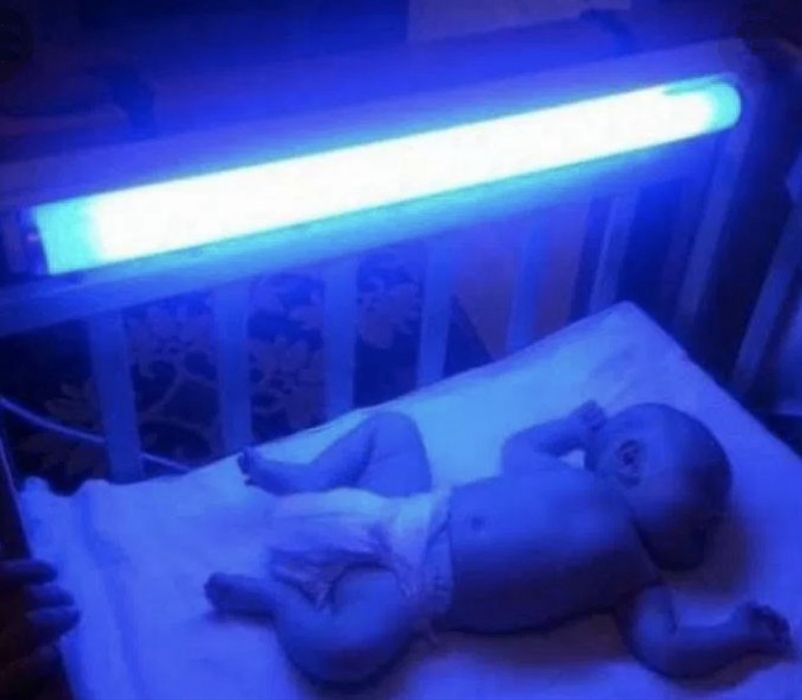 Лампа для лікування жовтяниці у немовлят