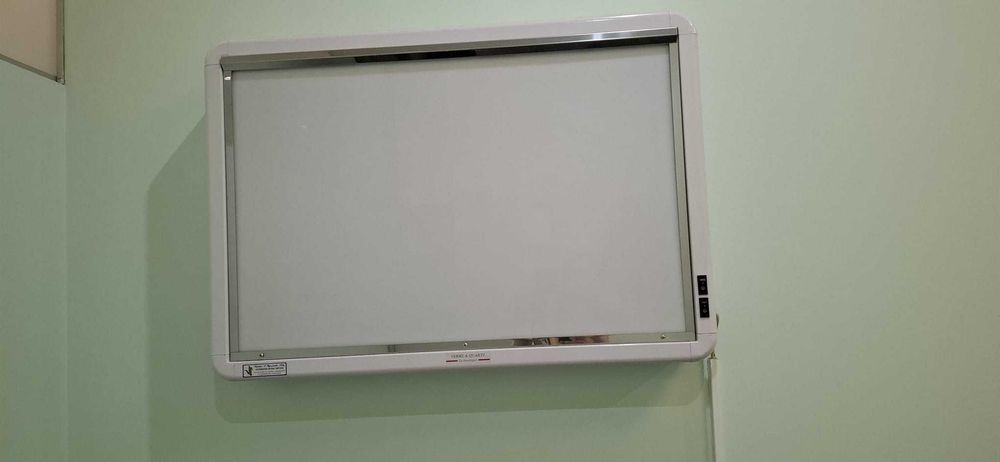 Negatoscópio 2 corpos, em chapa de aço inoxidável - NOVO