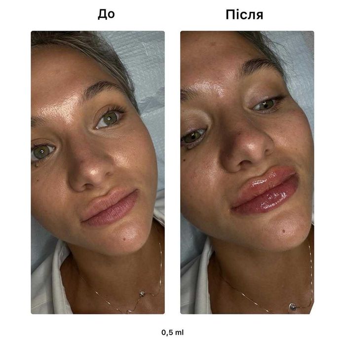 Лікар-косметолог Київ Святошин