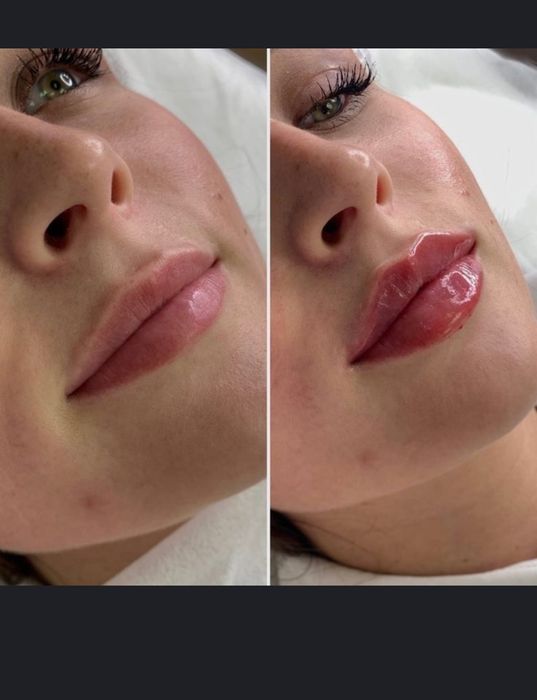 Косметолог Мукачево , по доступним цінам