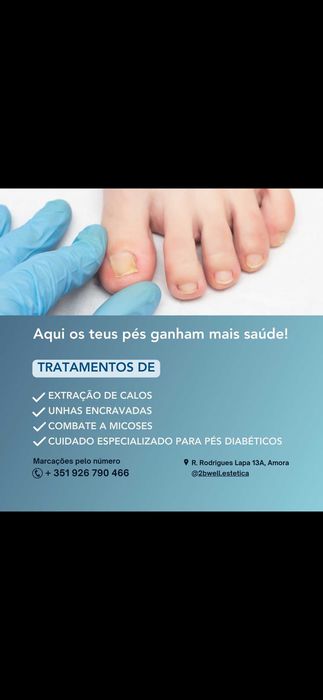 Tratamentos dos pés/Podologia