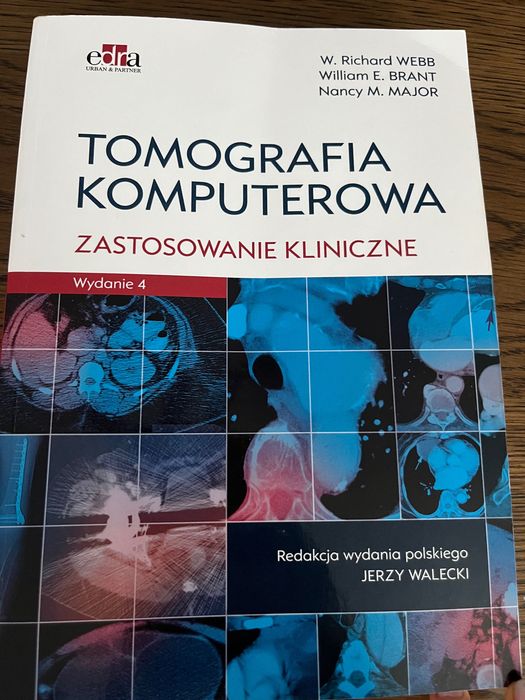 Tomografia komputerowa zastosowanie kliniczne Webb