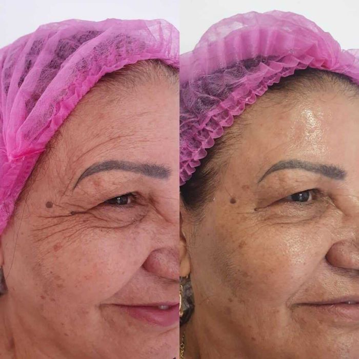 ADEUS RUGAS! O Segredo da Juventude foi Revelado