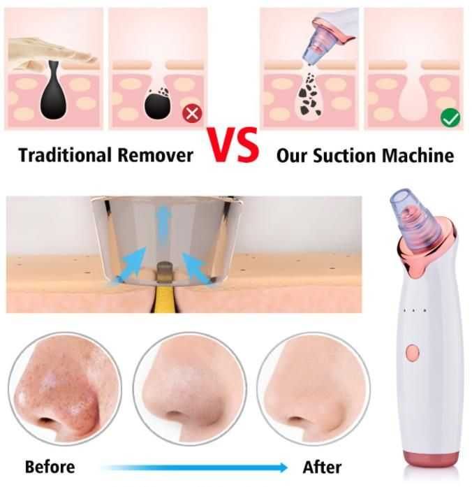 Аппарат вакуумной чистки лица