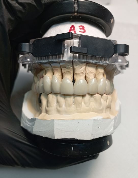 Зубний Технік /Металокераміст