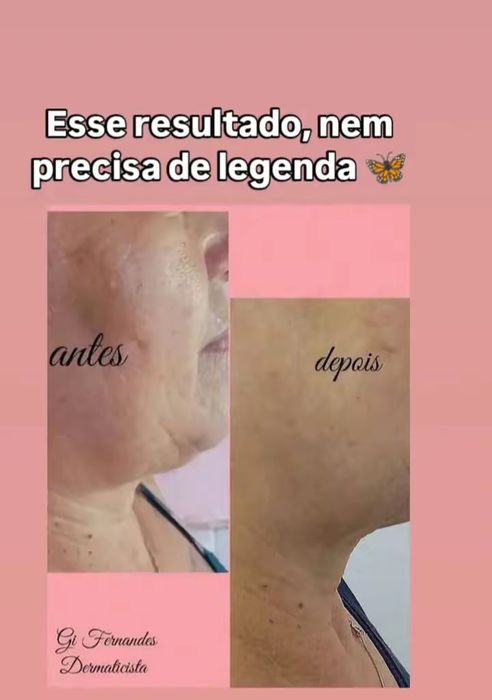 Serviço estético