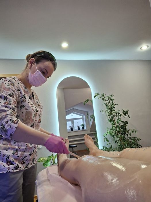 Лазерна епіляція