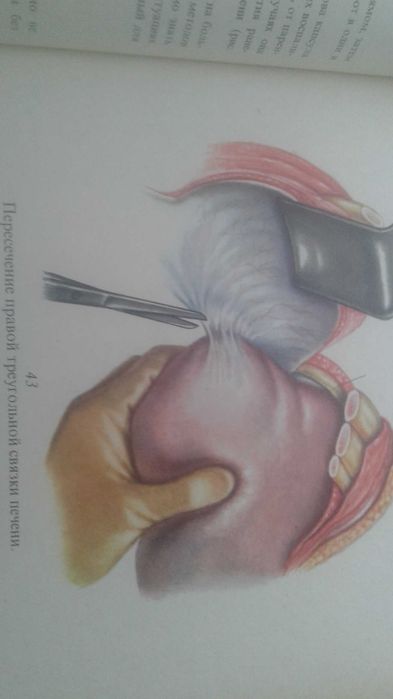 Атлас операций на печени 1975 год