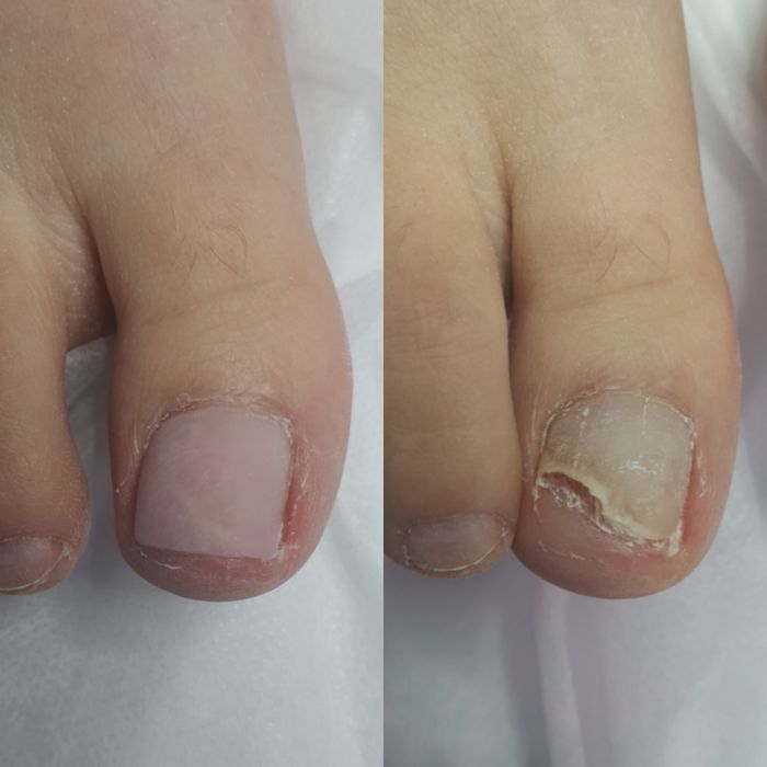 Pedicure, podolog Gdańsk