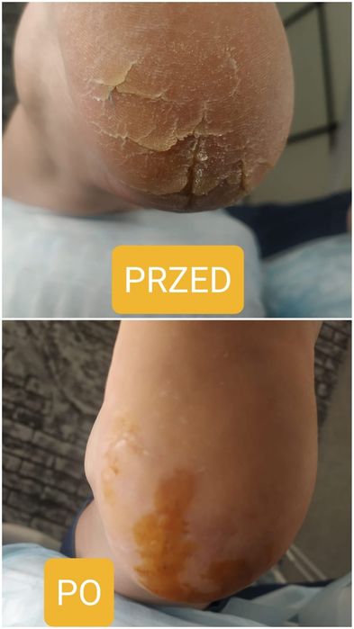 Manicure hybrydowy Z dojazdem Pedicure PODOLOGICZNY