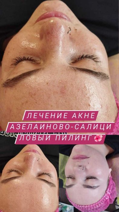 Обучение шугарингу и косметологии с 0!!!