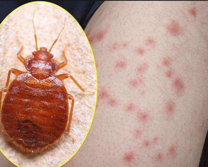 Dezynsekcja Odpluskwianie Najniższe ceny, i skuteczność gwaranowana