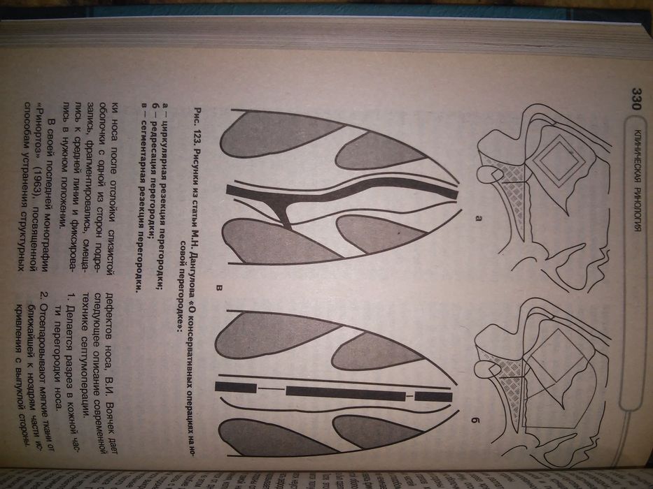 Пискунов Клиническая ринология. 2002
