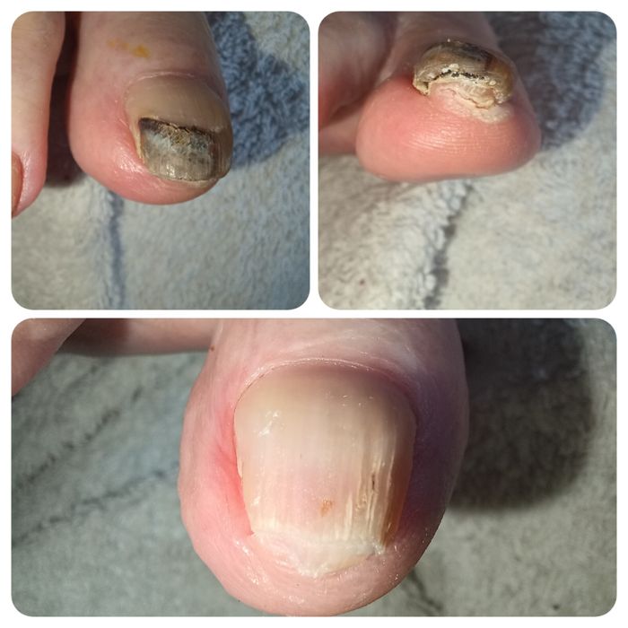 Pedicure medicinal ao domicílio