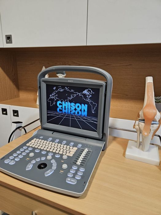 Ecógrafo Chison 1 para fisioterapia