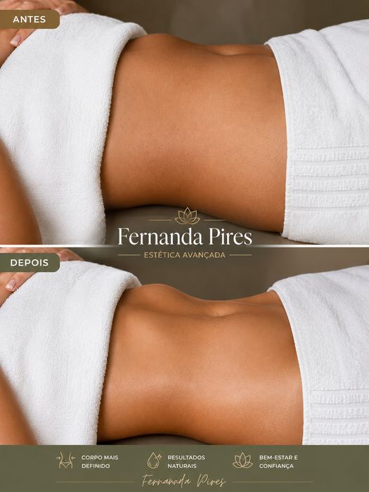 Massagem Terapêutica para o Seu Bem-Estar