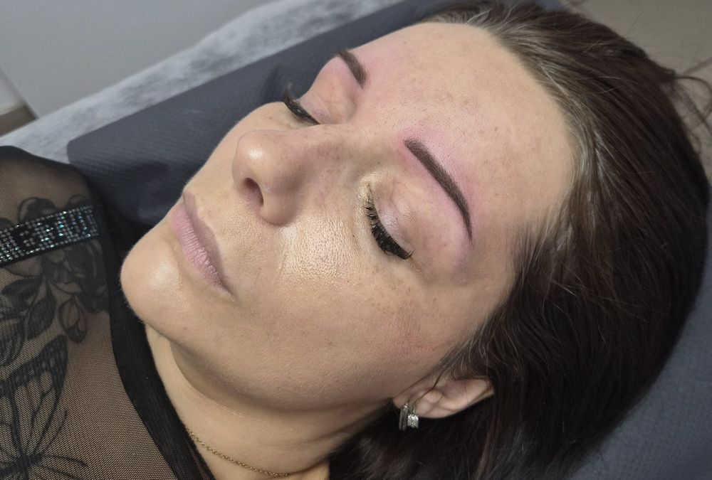 Makijaż permanentny, mezoterapia mikroigłowa