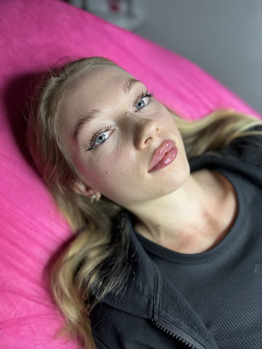 Збільшення губ , ботокс, косметолог