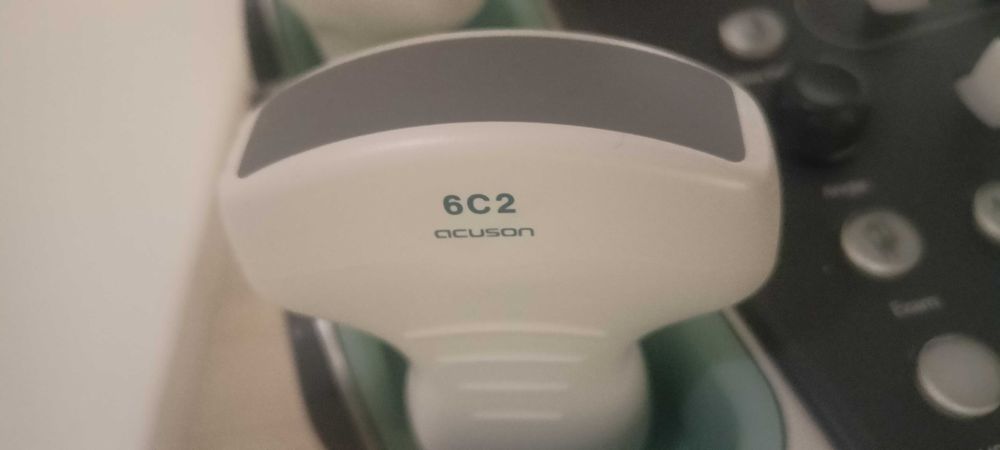 УЗД Апарат Siemens ACUSON X700, УЗИ сканер