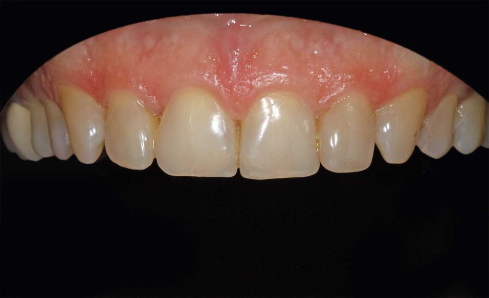 Canon 105/2.8 Macro Sigma HSM OS предметне фото, стоматологія, природа