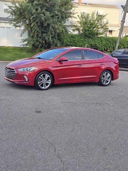 Hyundai Elantra      2017