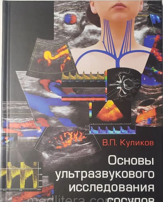Куликов В. П. Основи ультразвукового дослідження судин / УЗІ судин