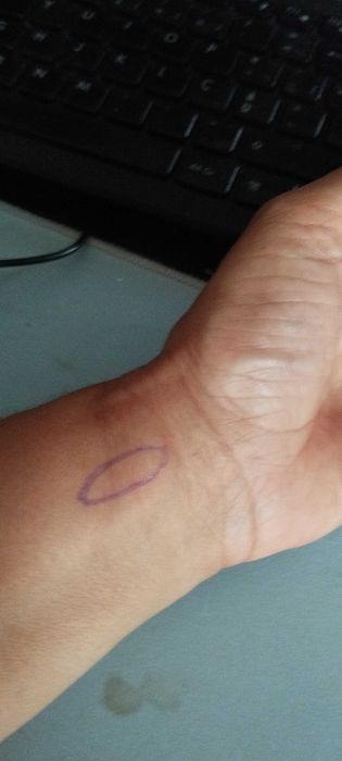 Reabilitação pós cirurgia e fisioterapia