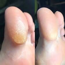 Мужской педикюр и маникюр в Запорожье, педикюр военным, подолог