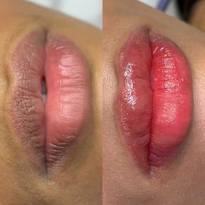 PROMO - Micropigmentação Labial