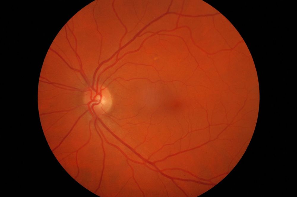 Retinografo kowa nonmyd 7