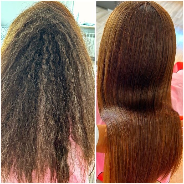 Keratynowe prostowanie, Krioterapia, NANOPLASTIA, Botox