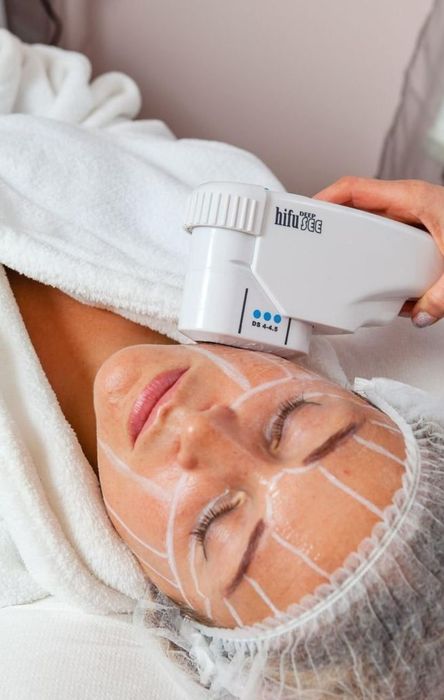 Hifu, microagulhamento, Microblading,