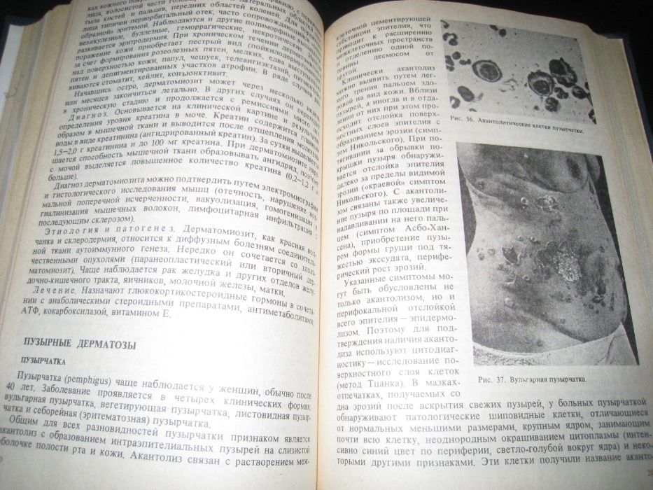 Книга Кожные и венерические заболевания
