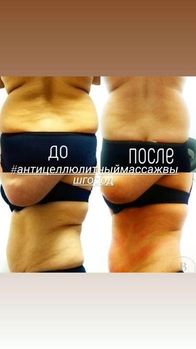 Масаж,Масаж обличчя,Антицелюлітний масаж,Пресотерапія,Styx обгортання