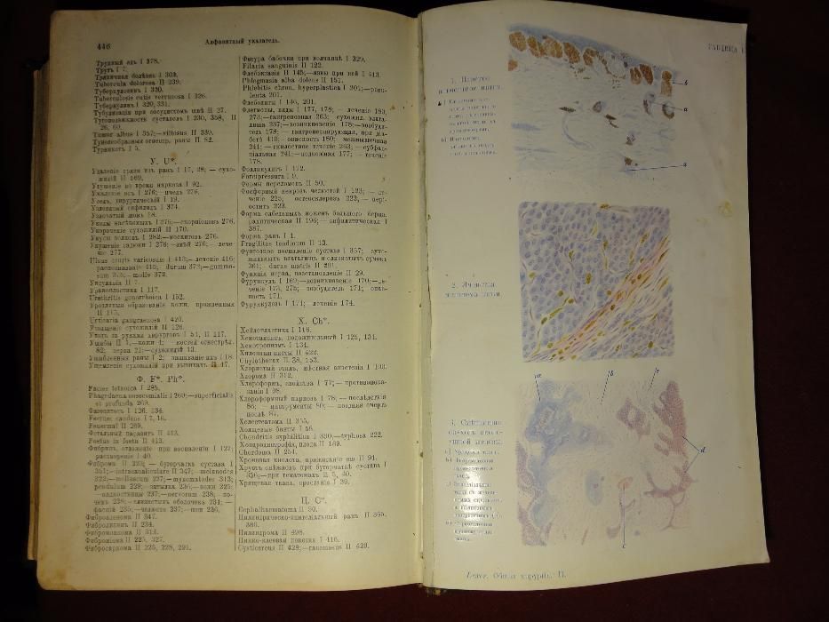 Раритет, редкая книга по Хирургии 1906 г. Кёнигсберг