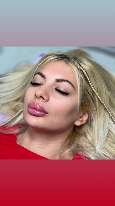 Косметолог, увеличить губы, пілінг, контурна пластика