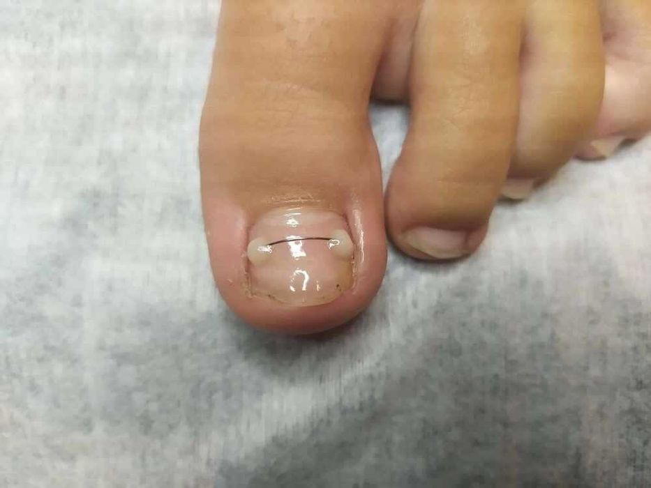 Podologia/Pedicure