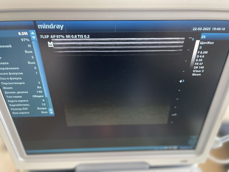 Цветной аппарат с допплером Mindray Z6 с 2 датчиками