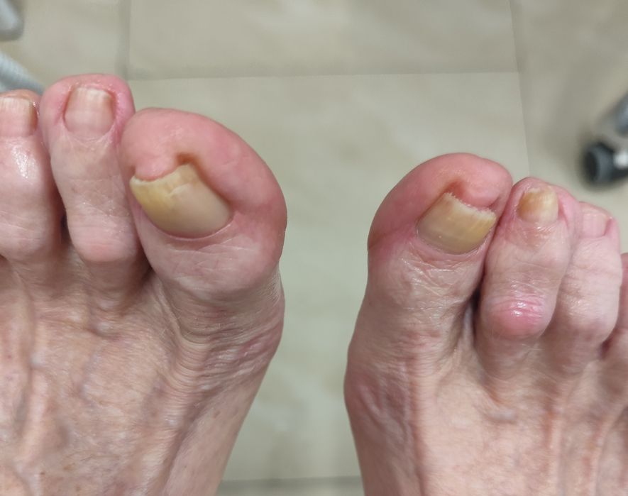 Podolog  mobilny, pedicure , manicure hybrydowy z dojazdem. Poznań. Luboń