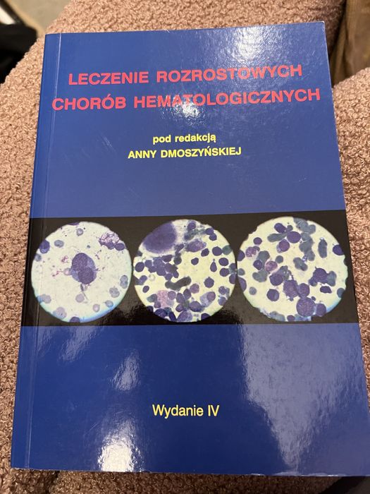 Leczenie rozrostowych chorób hematologicznych Dmoszyńska
